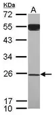 Anti-GAS41 antibody used in Western Blot (WB). GTX118115
