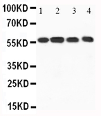 Anti-CaMKK1 antibody used in Western Blot (WB). GTX11812