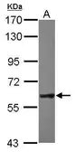 Anti-NXF2 antibody used in Western Blot (WB). GTX118122