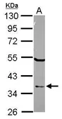 Anti-ELAC1 antibody used in Western Blot (WB). GTX118123