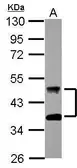 Anti-DNAJA4 antibody [N3C3] used in Western Blot (WB). GTX118124