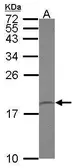 Anti-PPIL1 antibody [N1C3] used in Western Blot (WB). GTX118126