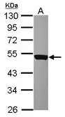 Anti-CD226 antibody [N1C2] used in Western Blot (WB). GTX118131