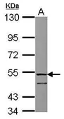 Anti-FSTL1 antibody [N1C2] used in Western Blot (WB). GTX118133