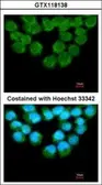 Anti-UFD1L antibody used in Immunocytochemistry/ Immunofluorescence (ICC/IF). GTX118138