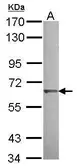 Anti-KLHL25 antibody [C1C3] used in Western Blot (WB). GTX118140