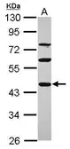 Anti-PDE7A antibody [N3C3] used in Western Blot (WB). GTX118143
