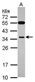 Anti-EXOSC8 antibody used in Western Blot (WB). GTX118146
