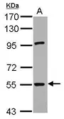 Anti-RNF168 antibody used in Western Blot (WB). GTX118147