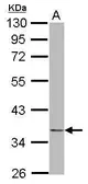 Anti-NDE1 antibody [N1C1] used in Western Blot (WB). GTX118153