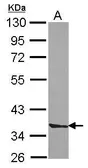 Anti-Septin 3 antibody [N2C3] used in Western Blot (WB). GTX118160