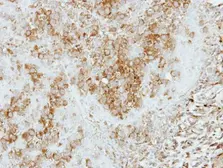 Anti-COPS4 antibody [N1C1] used in IHC (Paraffin sections) (IHC-P). GTX118165