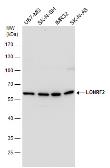 Anti-LONRF2 antibody used in Western Blot (WB). GTX118170