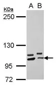 Anti-PCDHA10 antibody [N1N2], N-term used in Western Blot (WB). GTX118171