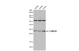 Anti-CHMP2B antibody used in Western Blot (WB). GTX118181