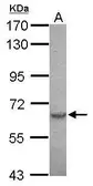 Anti-Serine palmitoyltransferase 2 antibody [N1N3] used in Western Blot (WB). GTX118192