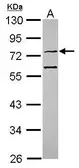 Anti-CMG1 antibody [N1N3] used in Western Blot (WB). GTX118199