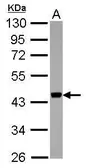 Anti-APOBEC3F antibody used in Western Blot (WB). GTX118217