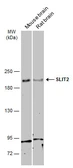 Anti-SLIT2 antibody used in Western Blot (WB). GTX118220