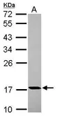 Anti-PPIH antibody used in Western Blot (WB). GTX118224