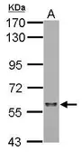 Anti-SF3A3 antibody used in Western Blot (WB). GTX118225
