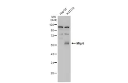 Anti-Mig-6 antibody [N1C1] used in Western Blot (WB). GTX118238