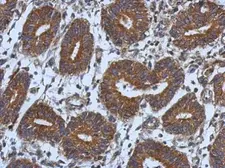 Anti-CNOT7 antibody [N1C1] used in IHC (Paraffin sections) (IHC-P). GTX118241