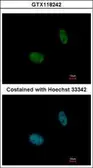 Anti-NANS antibody used in Immunocytochemistry/ Immunofluorescence (ICC/IF). GTX118242