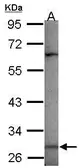 Anti-MAGEA3 antibody [N2C3] used in Western Blot (WB). GTX118244