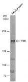 Anti-TNR antibody [C1C2], Internal used in Western Blot (WB). GTX118246