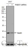 Anti-Rad51 antibody used in Western Blot (WB). GTX118249
