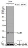 Anti-Rad51 antibody used in Western Blot (WB). GTX118249