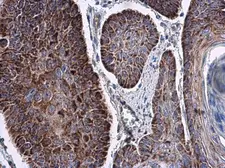Anti-RNF212 antibody used in IHC (Paraffin sections) (IHC-P). GTX118251