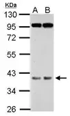 Anti-FBXO28 antibody used in Western Blot (WB). GTX118254
