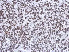 Anti-SMNDC1 antibody [N1C3-2] used in IHC (Paraffin sections) (IHC-P). GTX118263