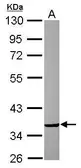 Anti-CRYZ antibody [N2C3] used in Western Blot (WB). GTX118269