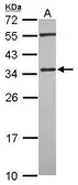 Anti-PDLIM4 antibody used in Western Blot (WB). GTX118281