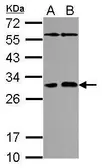 Anti-PAFAH1B2 antibody used in Western Blot (WB). GTX118289