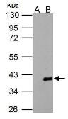 Anti-ARPC1A antibody used in Western Blot (WB). GTX118302