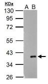 Anti-ARPC1A antibody used in Western Blot (WB). GTX118303