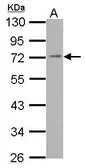 Anti-PDE4C antibody [N3C2], Internal used in Western Blot (WB). GTX118307