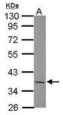 Anti-TAFI48 antibody [N1N3] used in Western Blot (WB). GTX118310