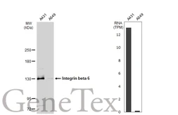 Anti-Integrin beta 6 antibody used in Western Blot (WB). GTX118323