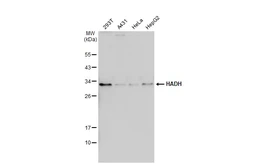 Anti-HADH antibody used in Western Blot (WB). GTX118325