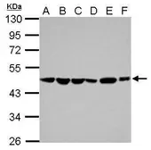 Anti-PAICS antibody used in Western Blot (WB). GTX118340