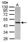 Anti-PAICS antibody [N1C1] used in Western Blot (WB). GTX118341