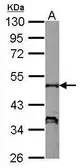 Anti-NCF1 antibody used in Western Blot (WB). GTX118361