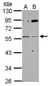 Anti-AChR gamma antibody used in Western Blot (WB). GTX118362