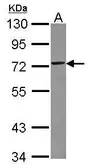 Anti-TRIM29 antibody [N3C3] used in Western Blot (WB). GTX118367