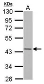 Anti-G protein alpha 16 antibody used in Western Blot (WB). GTX118385